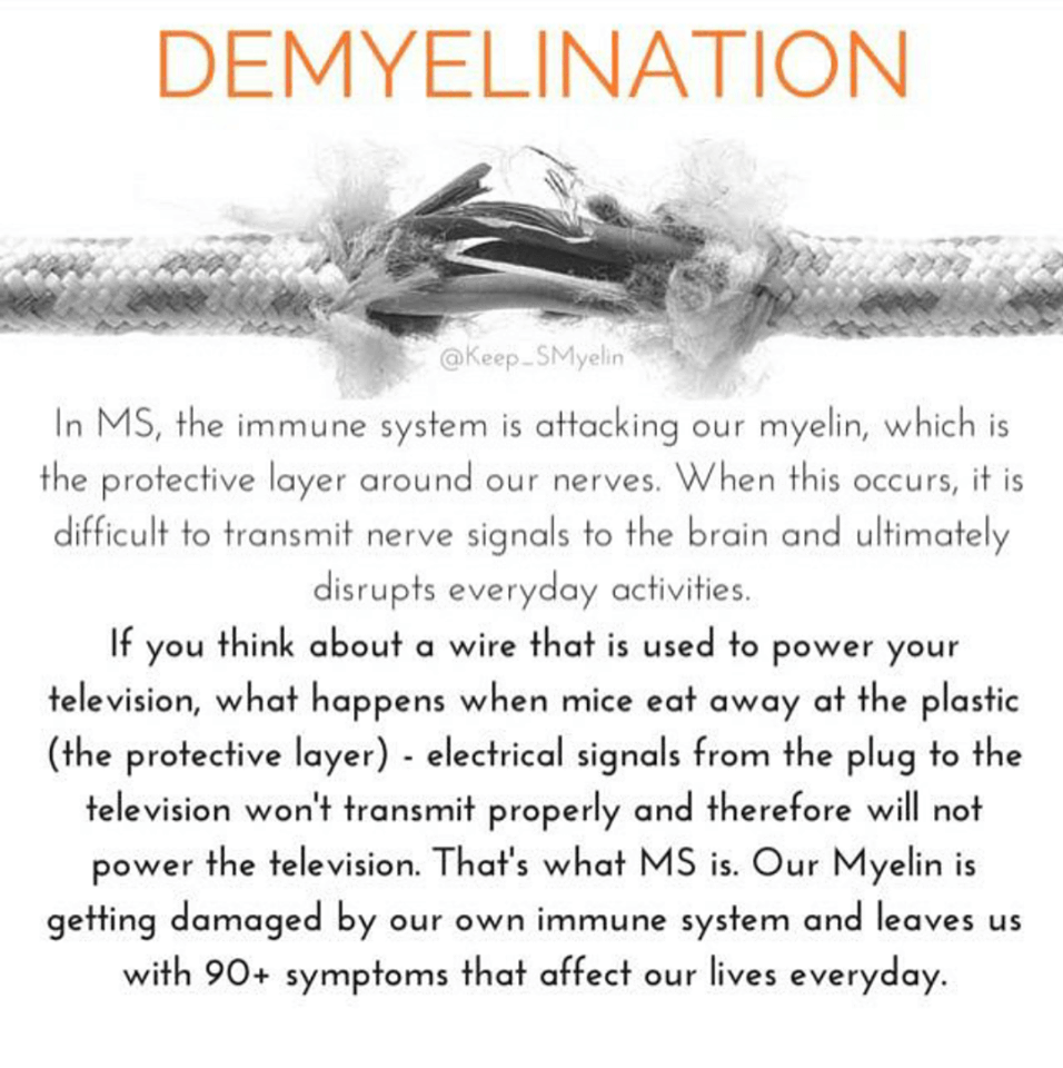 Living with MS - Demyelination